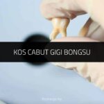 √ Kos Cabut Gigi Bongsu: Prosedur, Penjagaan, Harga 2024 Kos Cabut Gigi Bongsu
