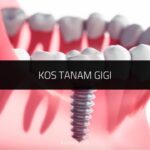 √ Kos Tanam Gigi: Jenis, Prosedur, Cara Rawatan LENGKAP 2024 Kos Tanam Gigi