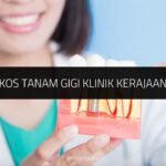 √ Kos Tanam Gigi Klinik Kerajaan: Prosedur & Cara Rawatan 2024 Kos Tanam Gigi Klinik Kerajaan