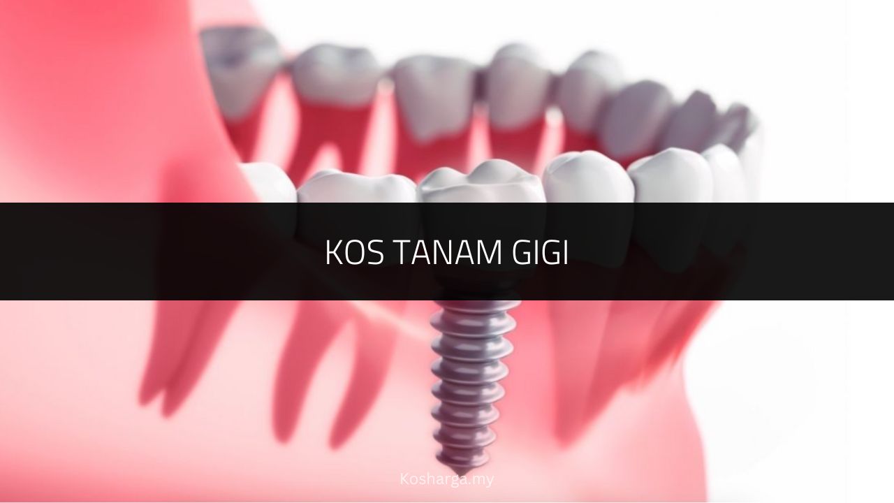Kos Tanam Gigi